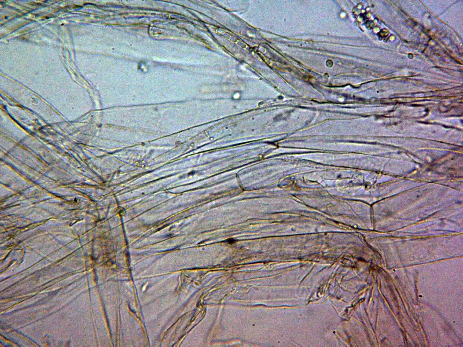 10 - Suprapellis agua x 400 5